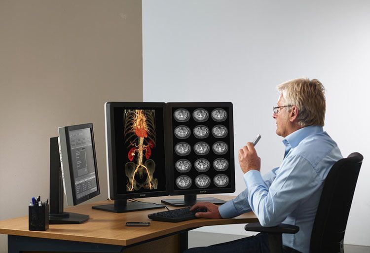Barco lectura radiologica en remoto