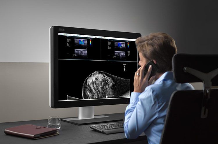 Barco lectura radiologica en remoto 2